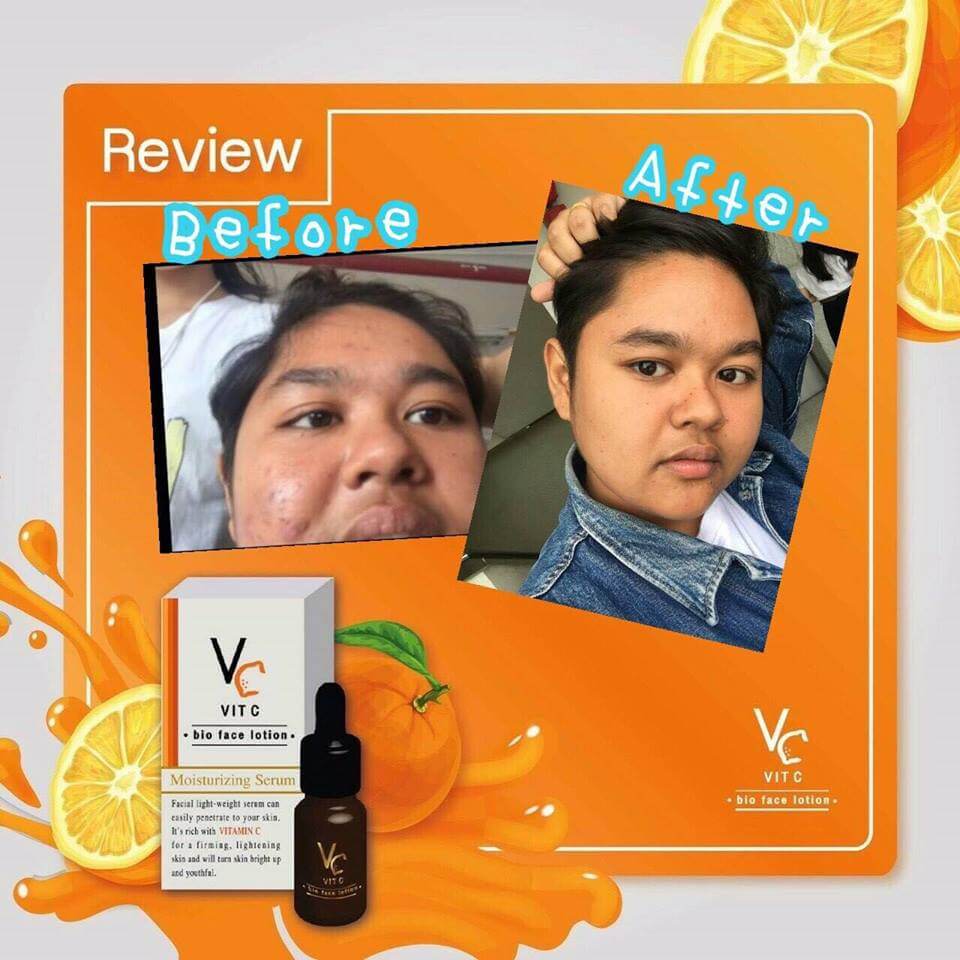 VitCBioFaceLotion ,VC ,VitC ,VitaminC ,น้ำใสๆแต่เด่นเรื่องบำรุง ,Serum VCเซรั่ม ,VCราคา,VCรีวิว,vit c bio face serum ของปลอม, vit c bio face serum วิธีใช้, vit c bio face serum ปลอม ,vit c bio face serum ดีไหม ,vit c bio face serum น้องฉัตร ,vit c bio face serum แพ้ ,vit c bio face serum first care serum 10ml ,vit c bio face serum ส่วนผสม ,vit c bio face serum - tity ,vit c bio face serum ใช้ดีไหม ,vit c bio face serum ,vit c bio face serum รีวิว ,vit c bio face serum ขายที่ไหน,vit c bio face serum ซื้อที่ไหน