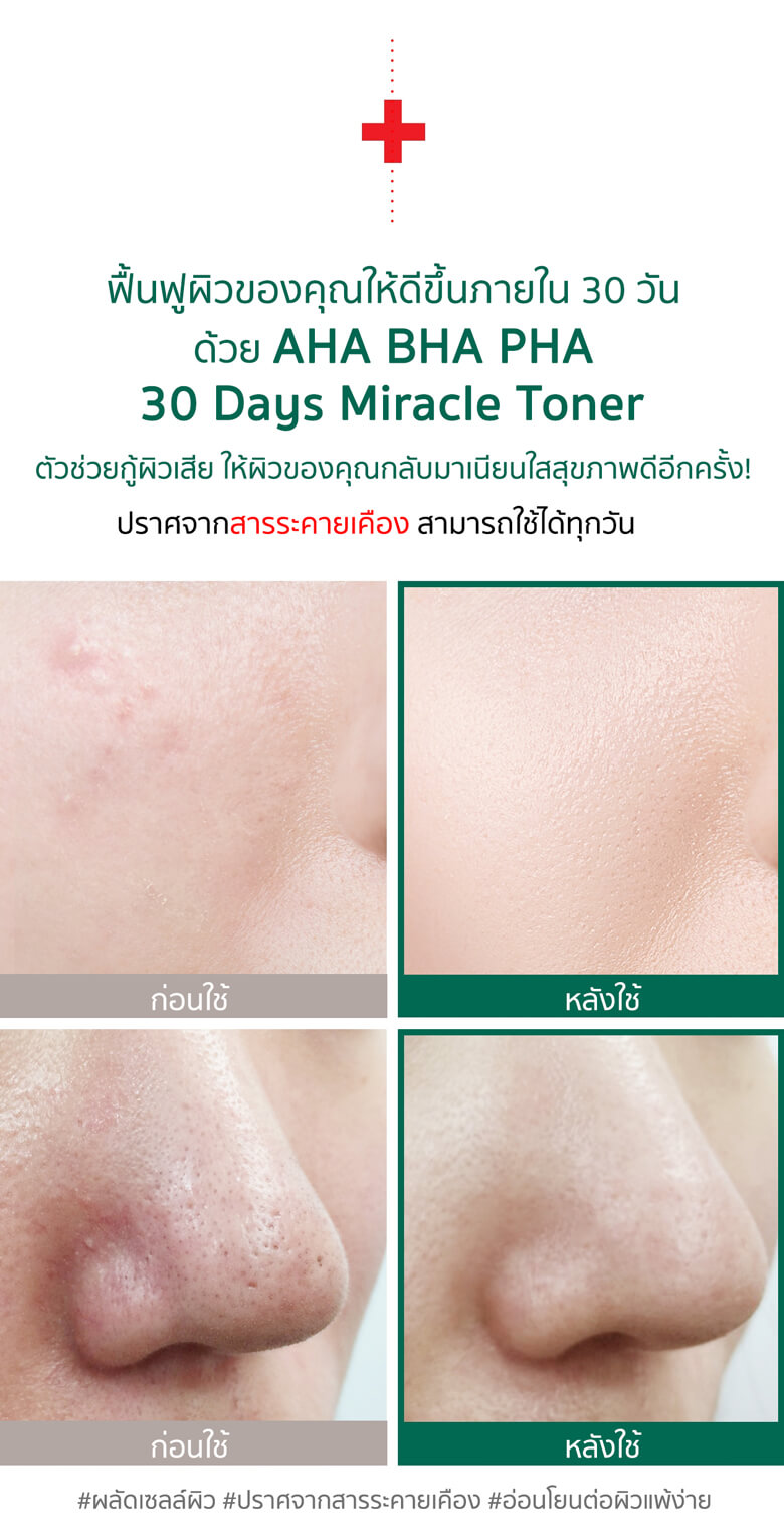 some by mi รีวิว,some by mi serum รีวิว,some by mi toner รีวิว,some by mi miracle toner ราคา,some by mi miracle toner รีวิว,some by mi miracle serum รีวิว,some by mi miracle toner review,some by mi โทนเนอร์