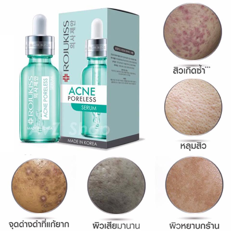 Rojukiss, Rojukiss Acne Poreless Serum, Rojukiss Acne Poreless Serum รีวิว, Rojukiss Acne Poreless Serum ราคา, Rojukiss Acne Poreless Serum pantip, Acne Poreless Serum, Rojukiss Acne Poreless Serum 18 ml. 