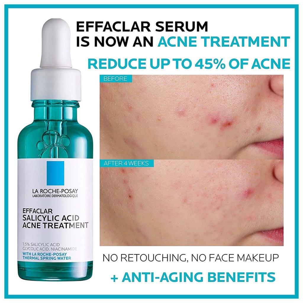 Effaclar Salicylic Acid Acne Treatment Serum 30ml เซรั่มรักษาสิวกรดซาลิไซลิกเนื้อบางเบานี้ช่วยขจัดรอยสิวและช่วยป้องกันการเกิดสิวใหม่